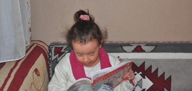 Balık Pulu" Hastası Çocuğa Belediye Başkanı Sahip Çıktı